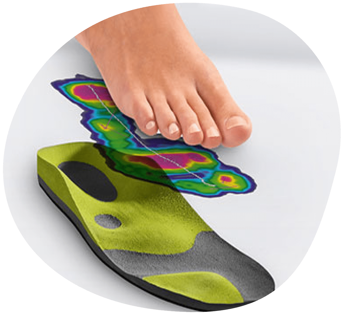 Fußabdruckanalyse mit Einlage