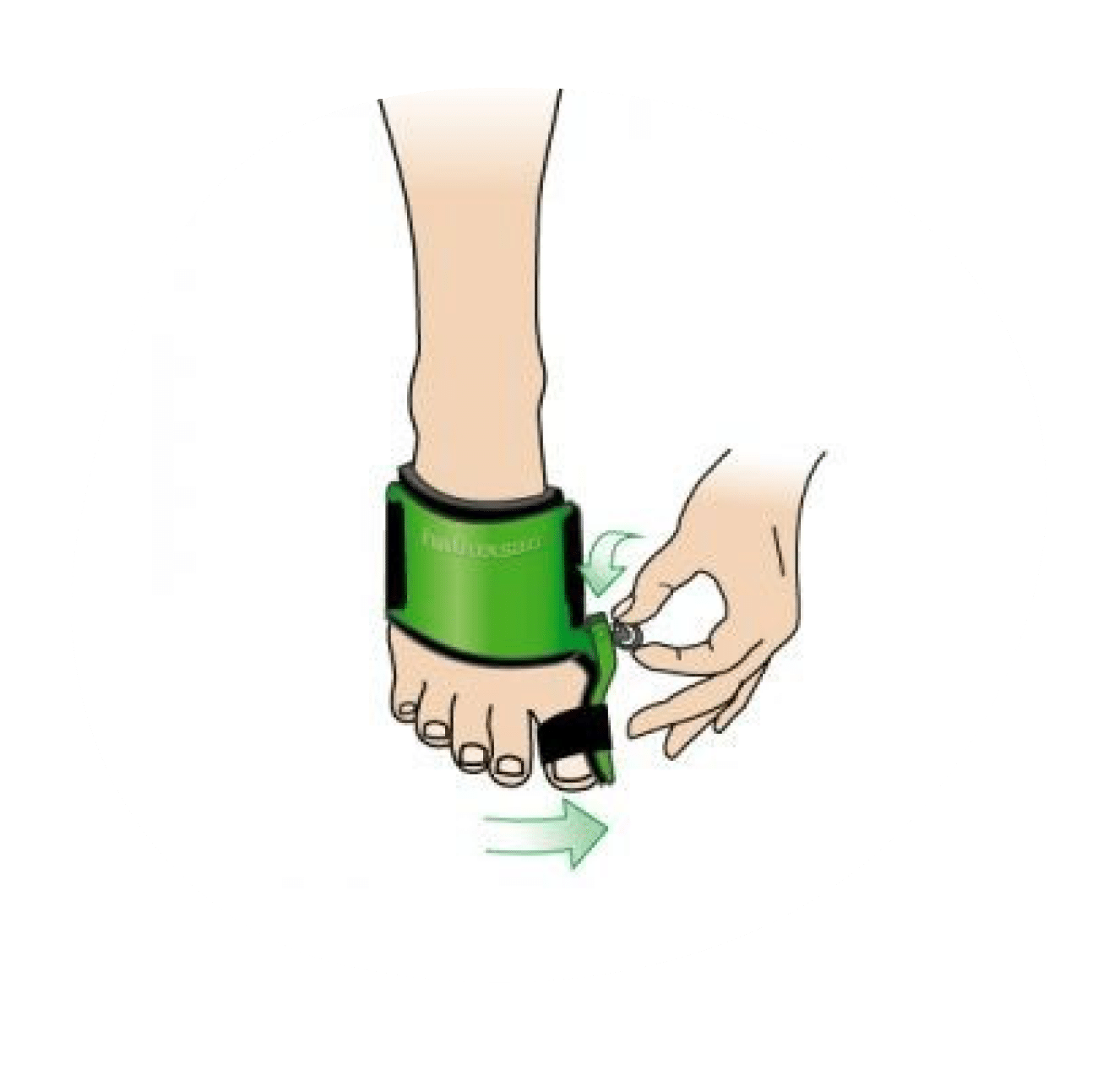 Fußbandage wird angelegt.